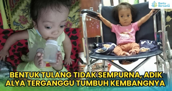 Bentuk Tulang Tidak Sempurna, Adik Alya Tumbuh Kembangnya Tidak Normal