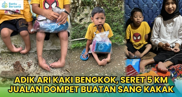 Seret Kaki 5 KM, Dik Ari Jualan Dompet Demi Bertahan Hidup