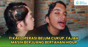 11 Kali Operasi Belum Cukup, Fajah  Masih Berjuang Bertahan Hidup