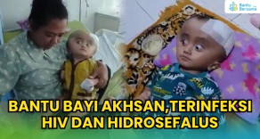 Bantu Bayi Akhsan,Terinfeksi HIV Dan Hidrosefalus