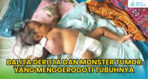 Derlita, Bayi 9 Bulan Melawan Tumor Langka Yang Mengancam Nyawanya