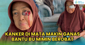 Kanker Di Mata Makin Ganas, Bantu Bu Mimin Berobat