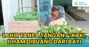 Lahir Tanpa Tangan & Kaki, Ilham Dibuang Dari Bayi