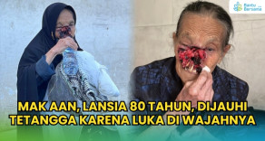 Mak Aan, Lansia 80 Tahun, Dijauhi Tetangga Karena Luka Di Wajahnya