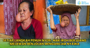Setiap Langkah Penuh Nyeri, Mak Iroh Berjuang Dengan Benjolannya