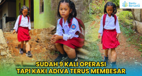 Sudah 9 Kali Operasi, Tapi Kaki Adiva Terus Membesar