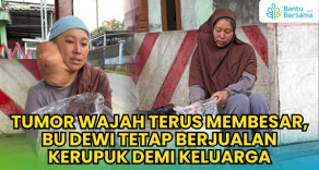 Tumor Wajah Terus Membesar, Bu Dewi Berjualan Kerupuk Demi Keluarga
