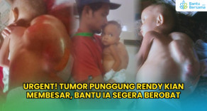 Urgent! Tumor Punggung Rendy Kian Membesar, Bantu Ia Segera Berobat